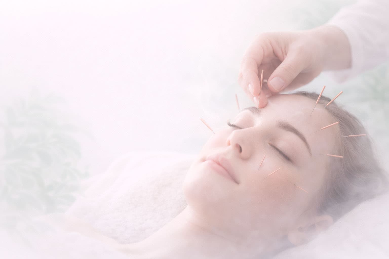 Acupuntura Estética Facial